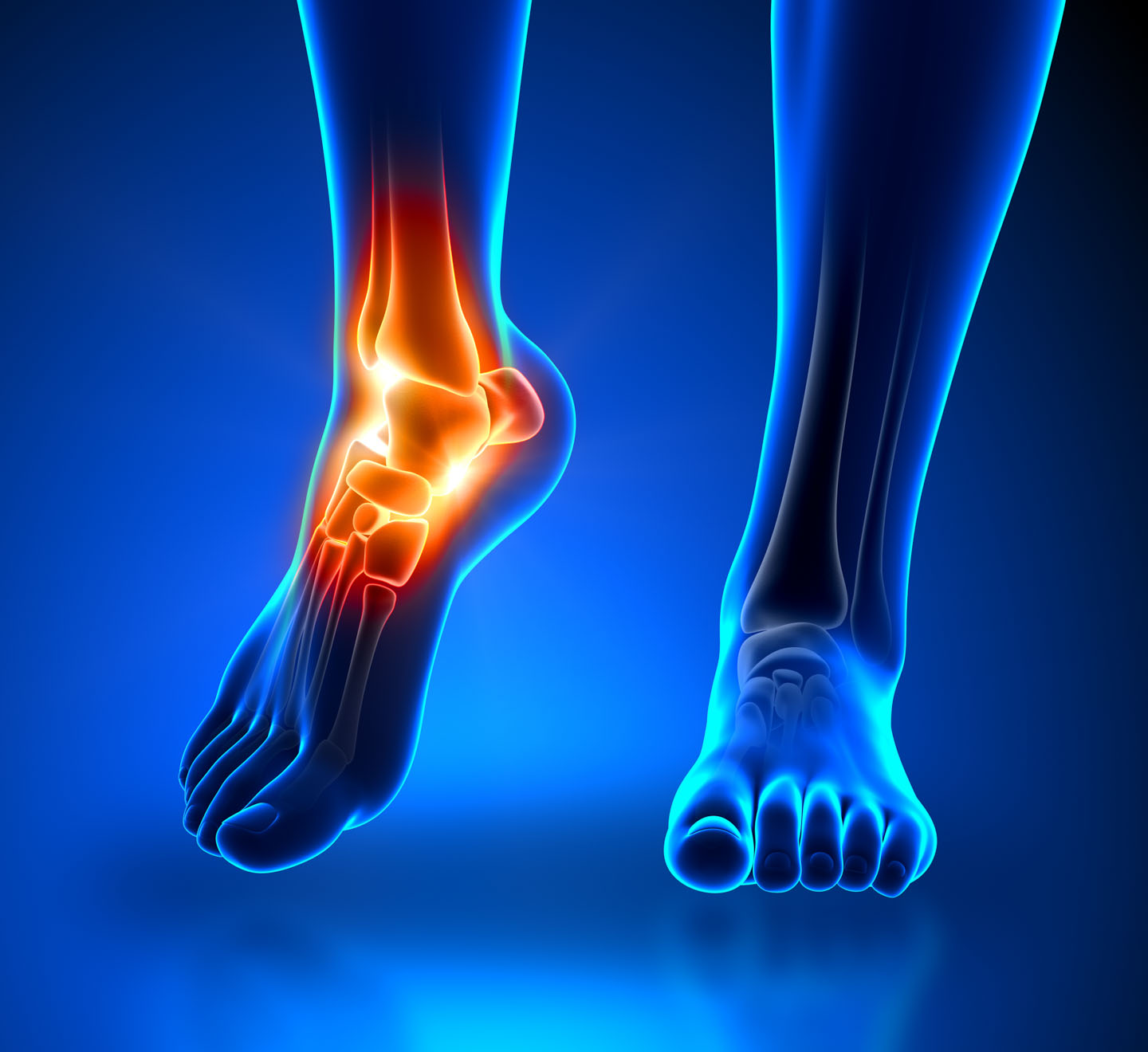 Foot & Ankle Pain